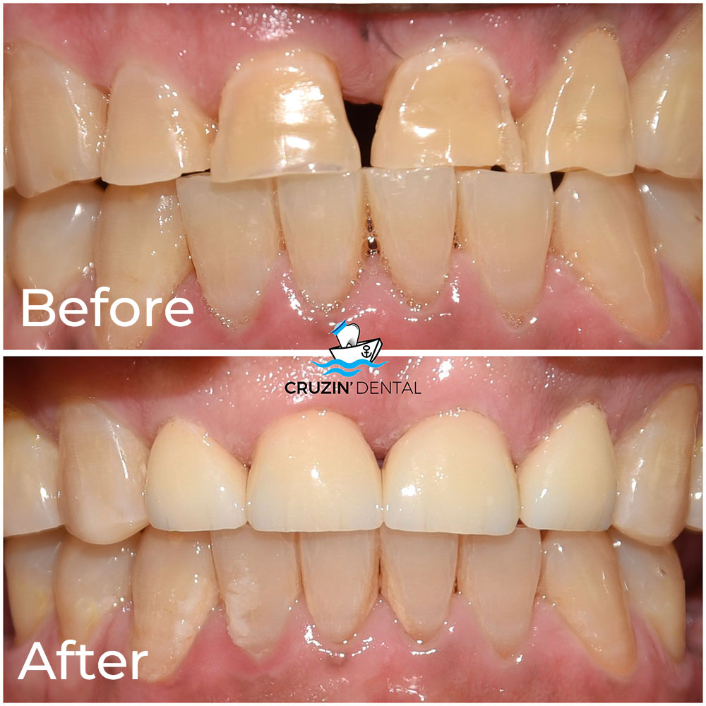 Cruzin  Dental | TMJ Disorders, Oral Exams and Intraoral Camera