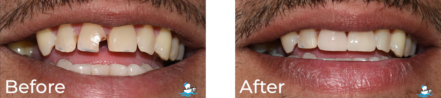 Cruzin  Dental | Sedation Dentistry, All-on-4 reg  and Pediatric Dentistry