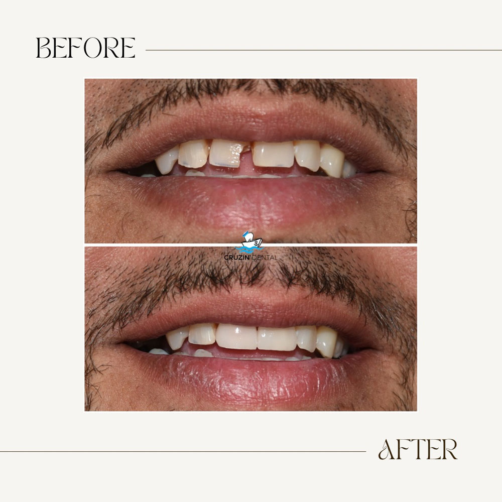 Cruzin  Dental | Pediatric Dentistry, CBCT and Cosmetic Dentistry