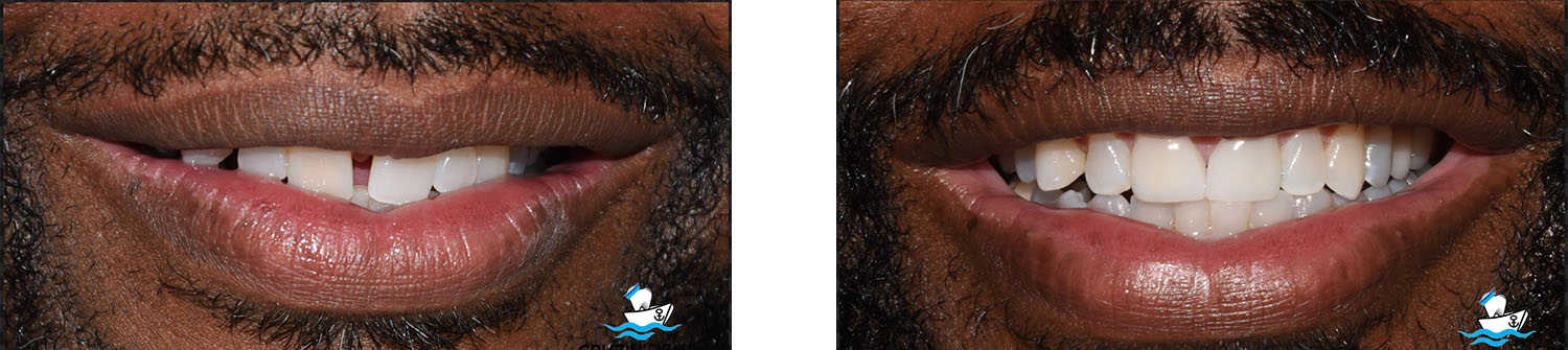 Cruzin' Dental | Oral Exams, Juvederm&reg; and Pediatric Dentistry