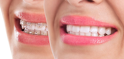 Cruzin  Dental | Extractions, CBCT and Periodontal Treatment