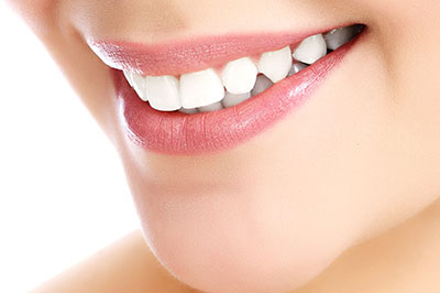 Cruzin  Dental | Inlays  amp  Onlays, Dermal Fillers and ZOOM  Whitening