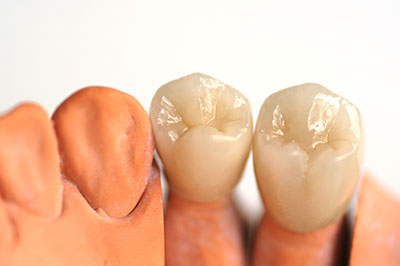 Cruzin  Dental | Night Guards, Intraoral Camera and CBCT