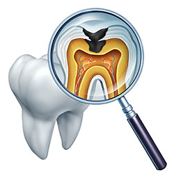 Cruzin  Dental | Veneers, Extractions and Intraoral Camera
