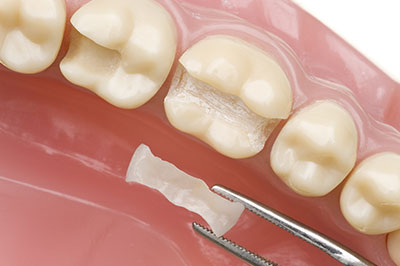 Cruzin  Dental | Dermal Fillers, Teeth Whitening and Dental Cleanings