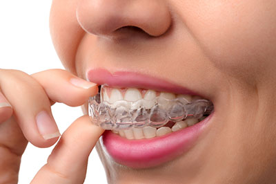Cruzin  Dental | Oral Cancer Screening, Inlays  amp  Onlays and Cosmetic Dentistry