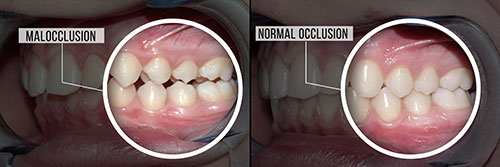 Cruzin  Dental | Sedation Dentistry, Juvederm reg  and Fluoride Treatment