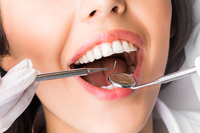 Cruzin  Dental | Crowns, Oral Cancer Screening and Preventative Program