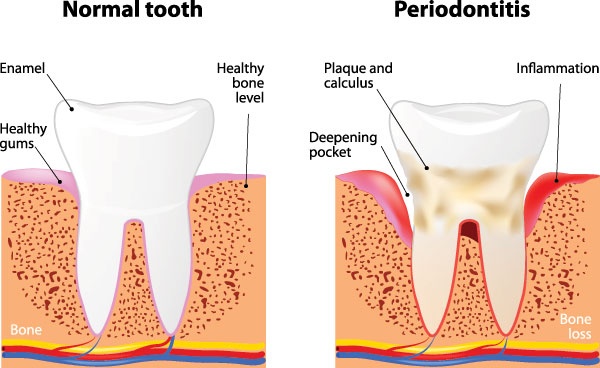 Cruzin  Dental | Dermal Fillers, Root Canals and Oral Cancer Screening