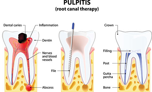 Cruzin  Dental | Dental Cleanings, Dermal Fillers and Dentures