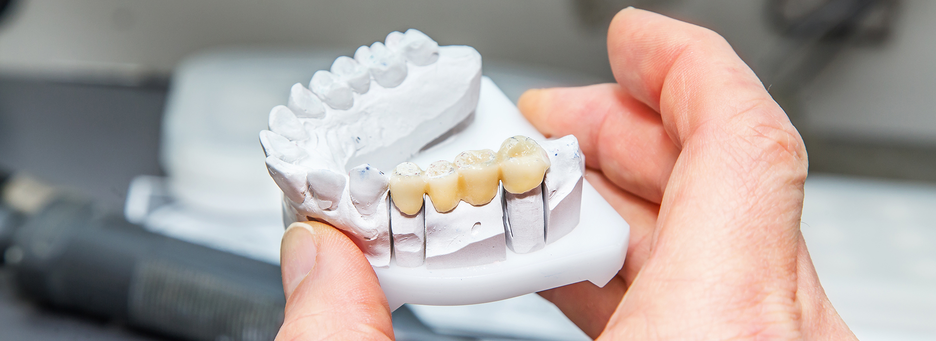 Cruzin  Dental | Root Canals, Dental Cleanings and Intraoral Camera