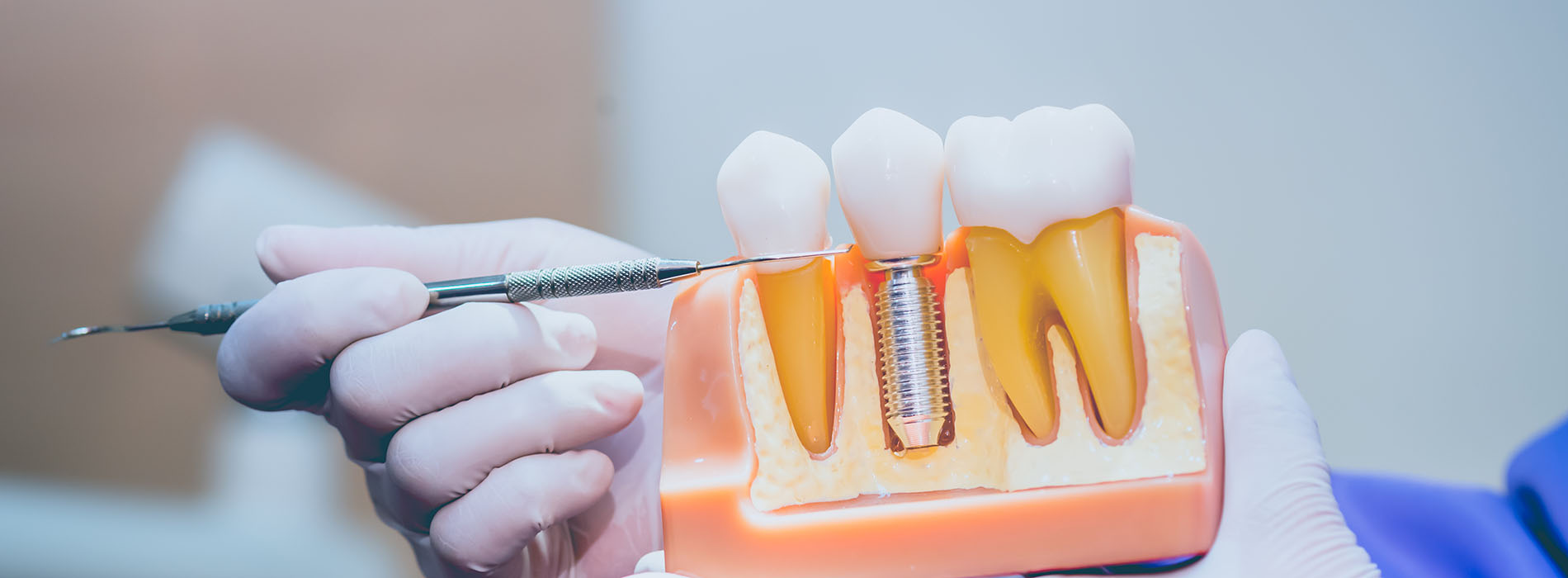 Cruzin  Dental | Juvederm reg , All-on-4 reg  and Dental Bridges