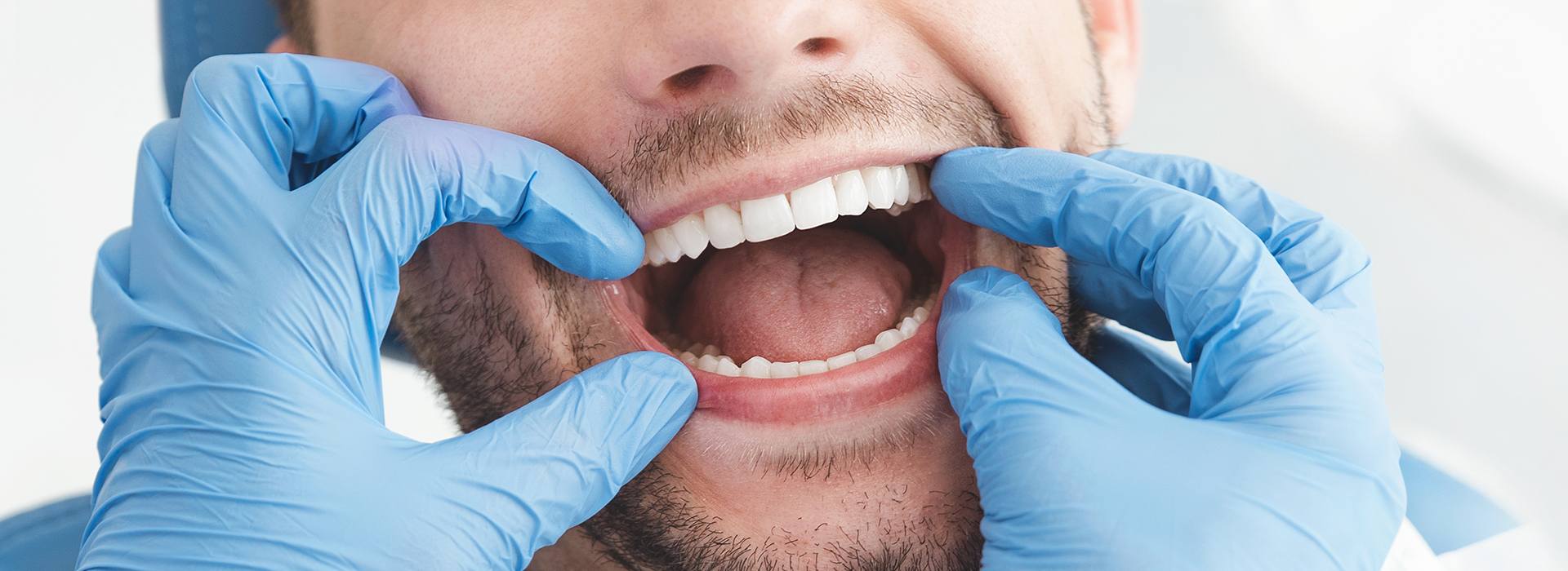 Cruzin  Dental | Preventative Program, Dental Sealants and Pediatric Dentistry