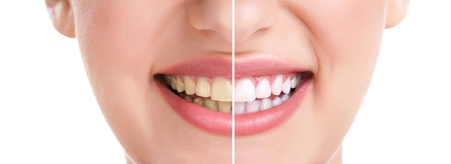 Cruzin  Dental | Dental Bridges, Extractions and Night Guards