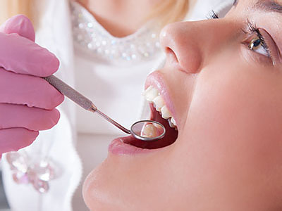 Cruzin  Dental | Emergency Treatment, All-on-4 reg  and Extractions