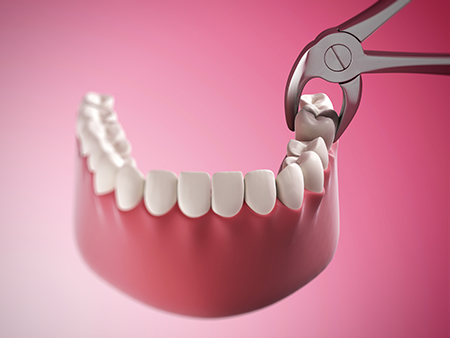 Cruzin  Dental | Night Guards, Dentures and Periodontal Treatment