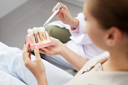 Cruzin  Dental | Inlays  amp  Onlays, Dentures and Dental Bridges