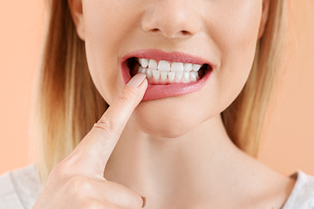 Cruzin  Dental | Preventative Program, Cosmetic Dentistry and Extractions